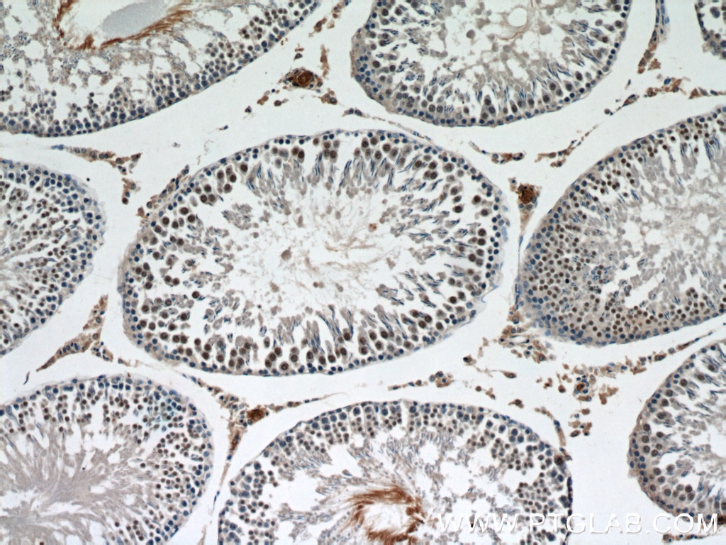 Immunohistochemistry (IHC) staining of rat testis tissue using KU70,XRCC6 Polyclonal antibody (10723-1-AP)