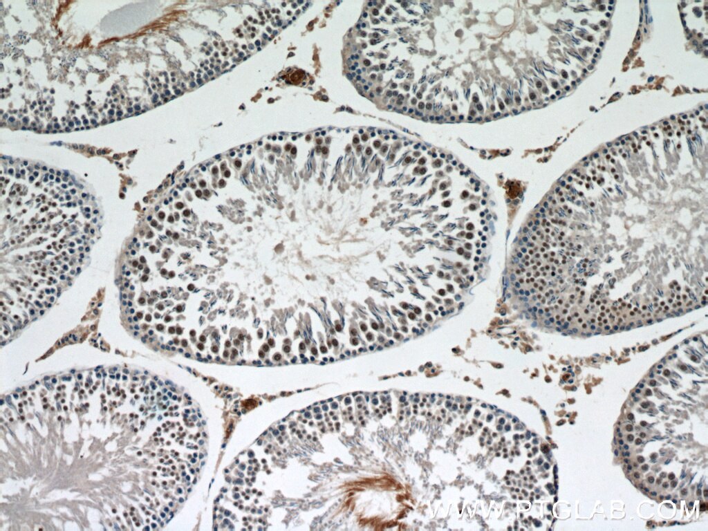 IHC staining of rat testis using 10723-1-AP