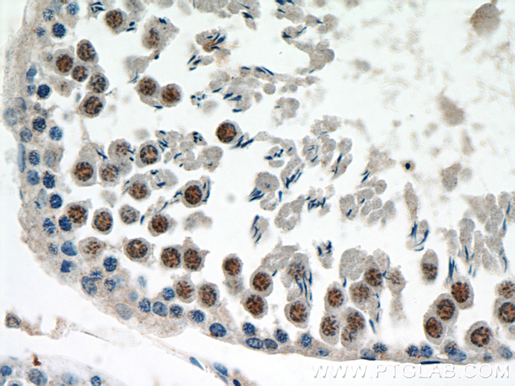 IHC staining of rat testis using 10723-1-AP