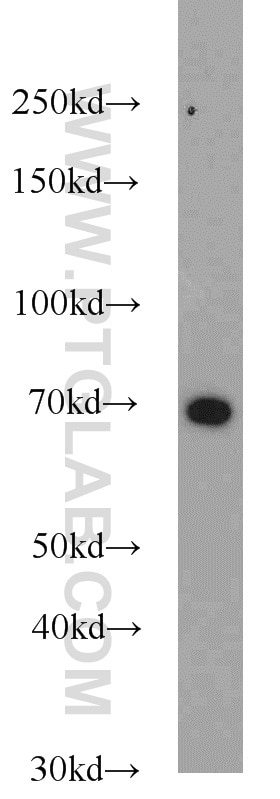 Western Blot (WB) analysis of A431 cells using KU70,XRCC6 Polyclonal antibody (10723-1-AP)