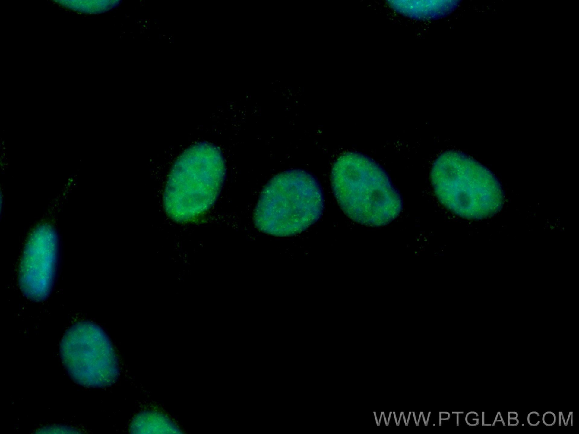 Immunofluorescence (IF) / fluorescent staining of HepG2 cells using KU70,XRCC6 Monoclonal antibody (66607-1-Ig)