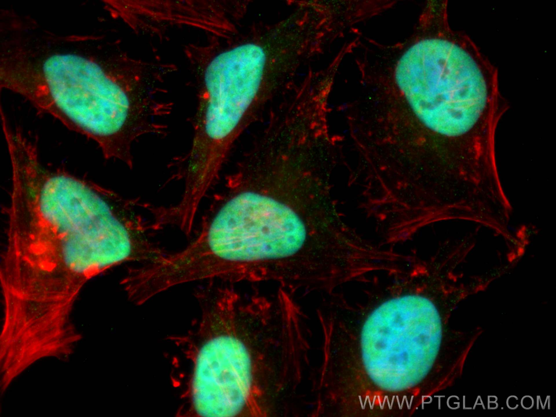 Immunofluorescence (IF) / fluorescent staining of HeLa cells using KU70,XRCC6 Monoclonal antibody (66607-1-Ig)