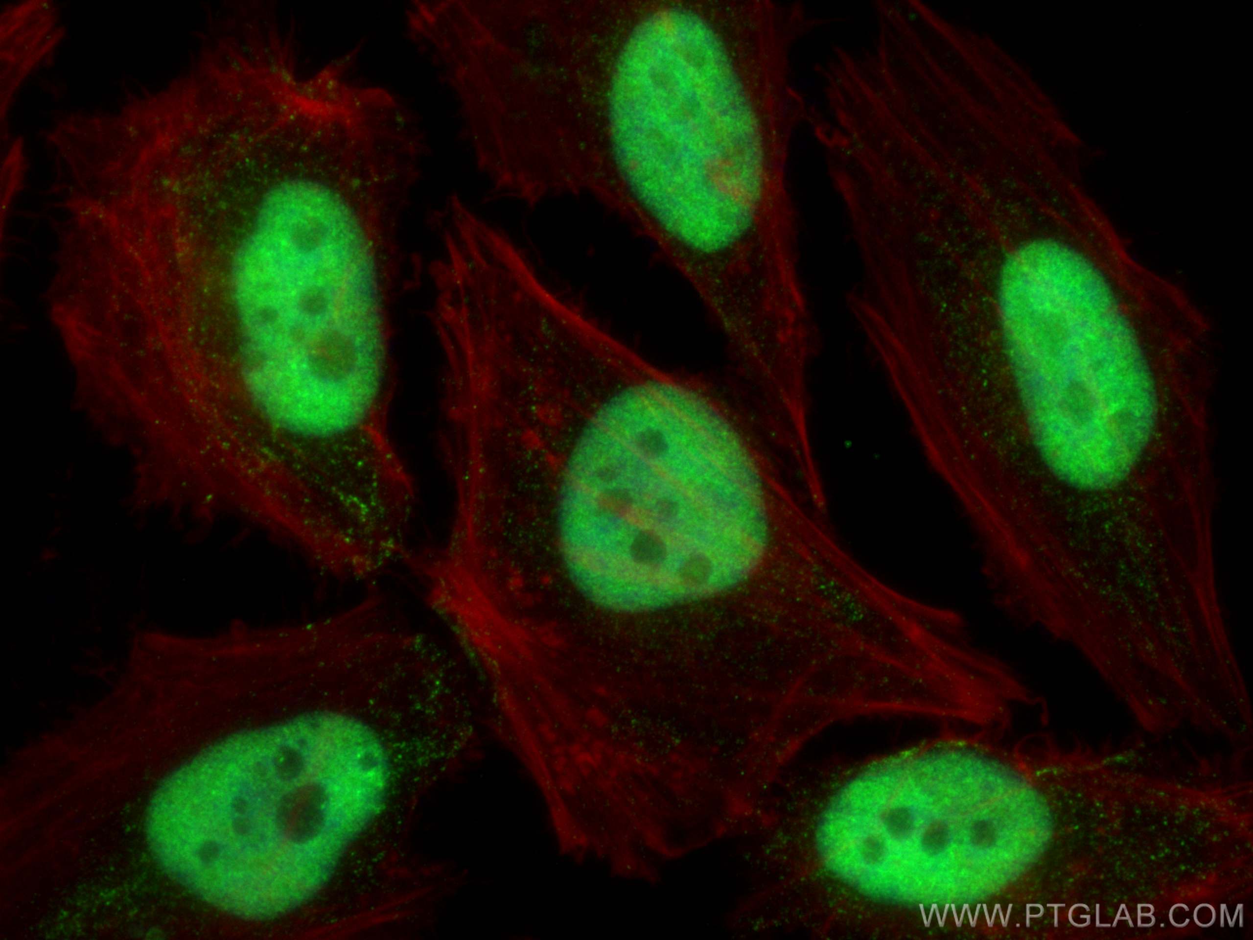 IF Staining of HeLa using 66607-1-Ig