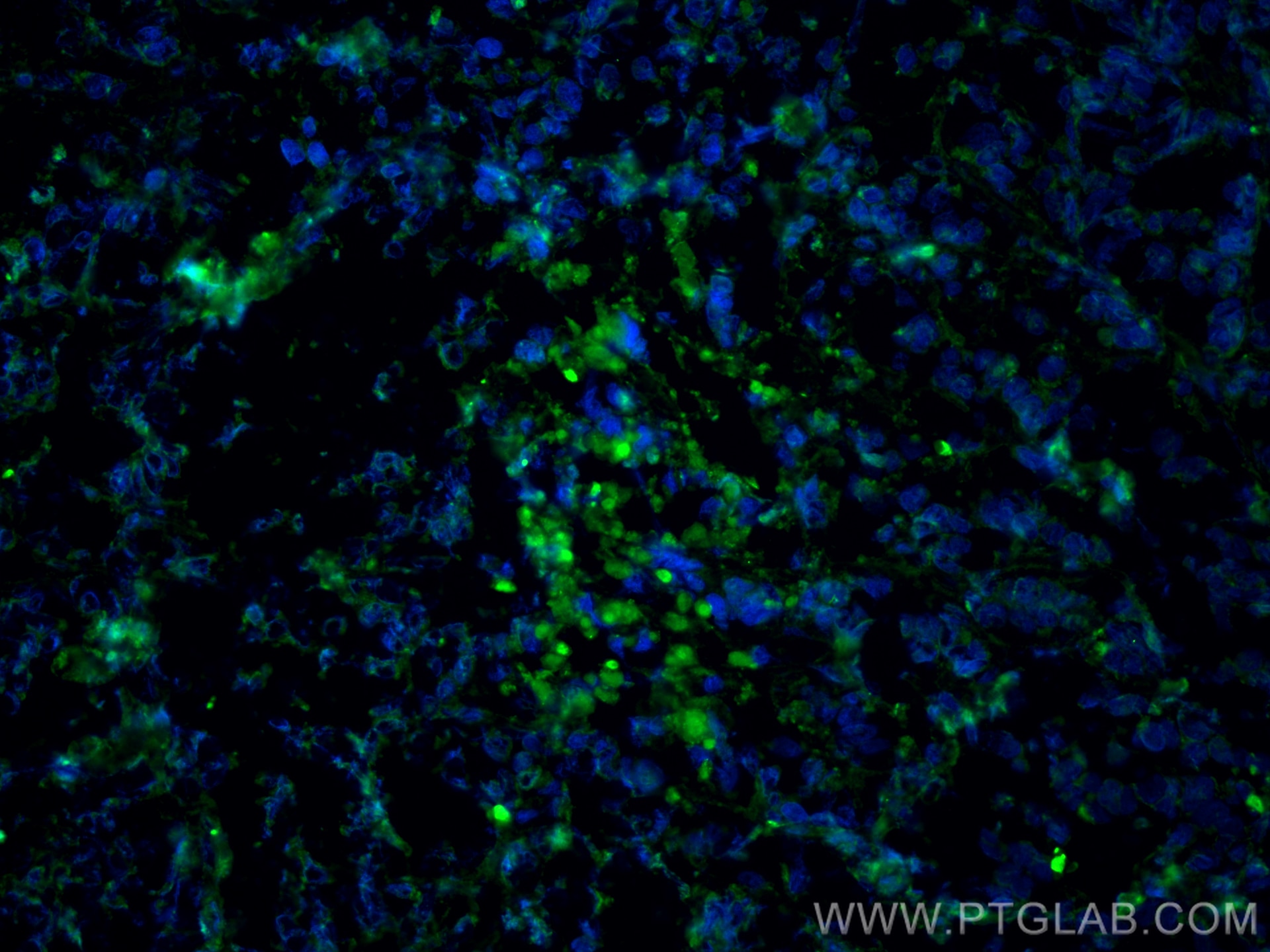 Immunofluorescence (IF) / fluorescent staining of mouse breast cancer using KU70,XRCC6 Monoclonal antibody (66607-1-Ig)