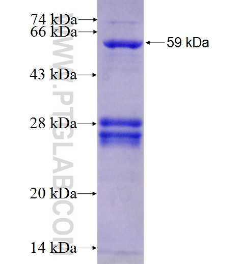 KU70,XRCC6 fusion protein Ag1043 SDS-PAGE