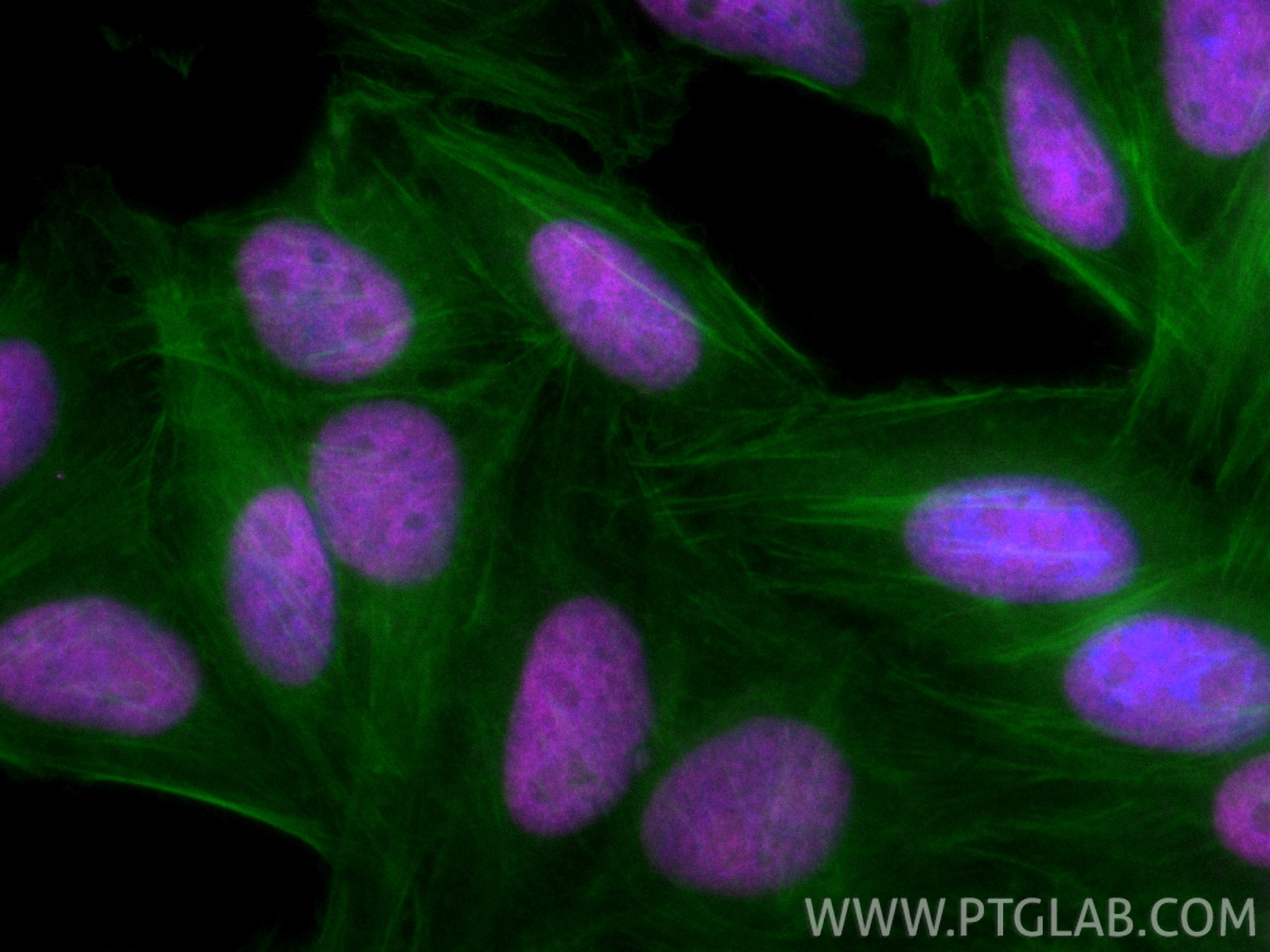 IF Staining of HepG2 using CL647-10723 Immunofluorescence (IF) / fluorescent staining of HepG2 cells using CoraLite® Plus 647-conjugated KU70/XRCC6 Polyclona (CL647-10723)