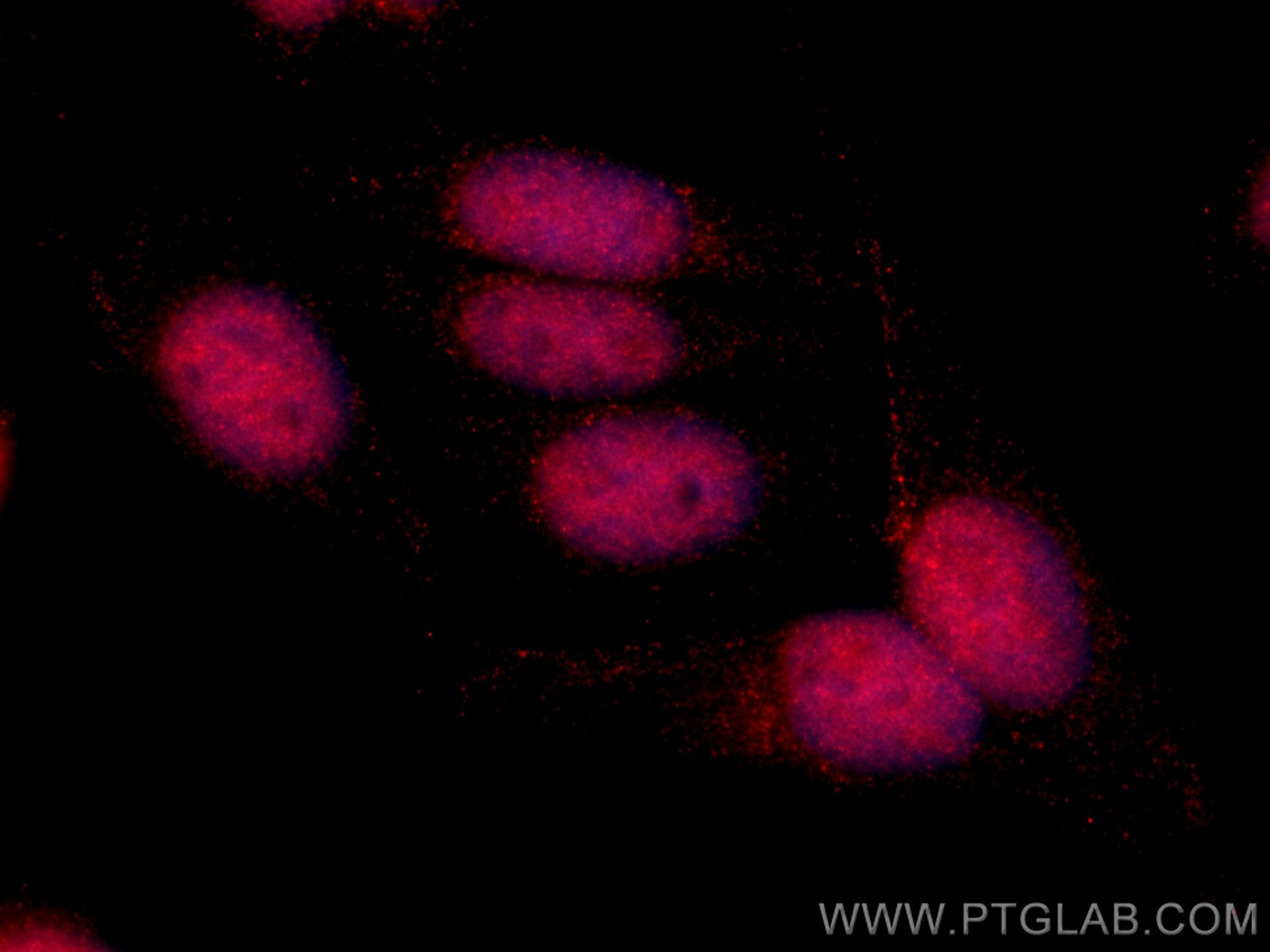 Immunofluorescence (IF) / fluorescent staining of HepG2 cells using CoraLite®594-conjugated KU70,XRCC6 Monoclonal anti (CL594-66607)