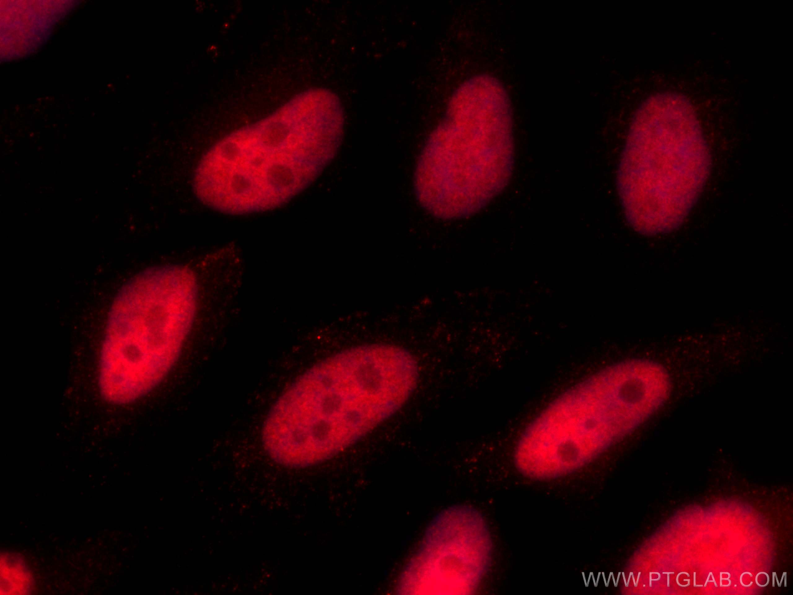 Immunofluorescence (IF) / fluorescent staining of HeLa cells using CoraLite®594-conjugated KU70,XRCC6 Monoclonal anti (CL594-66607)