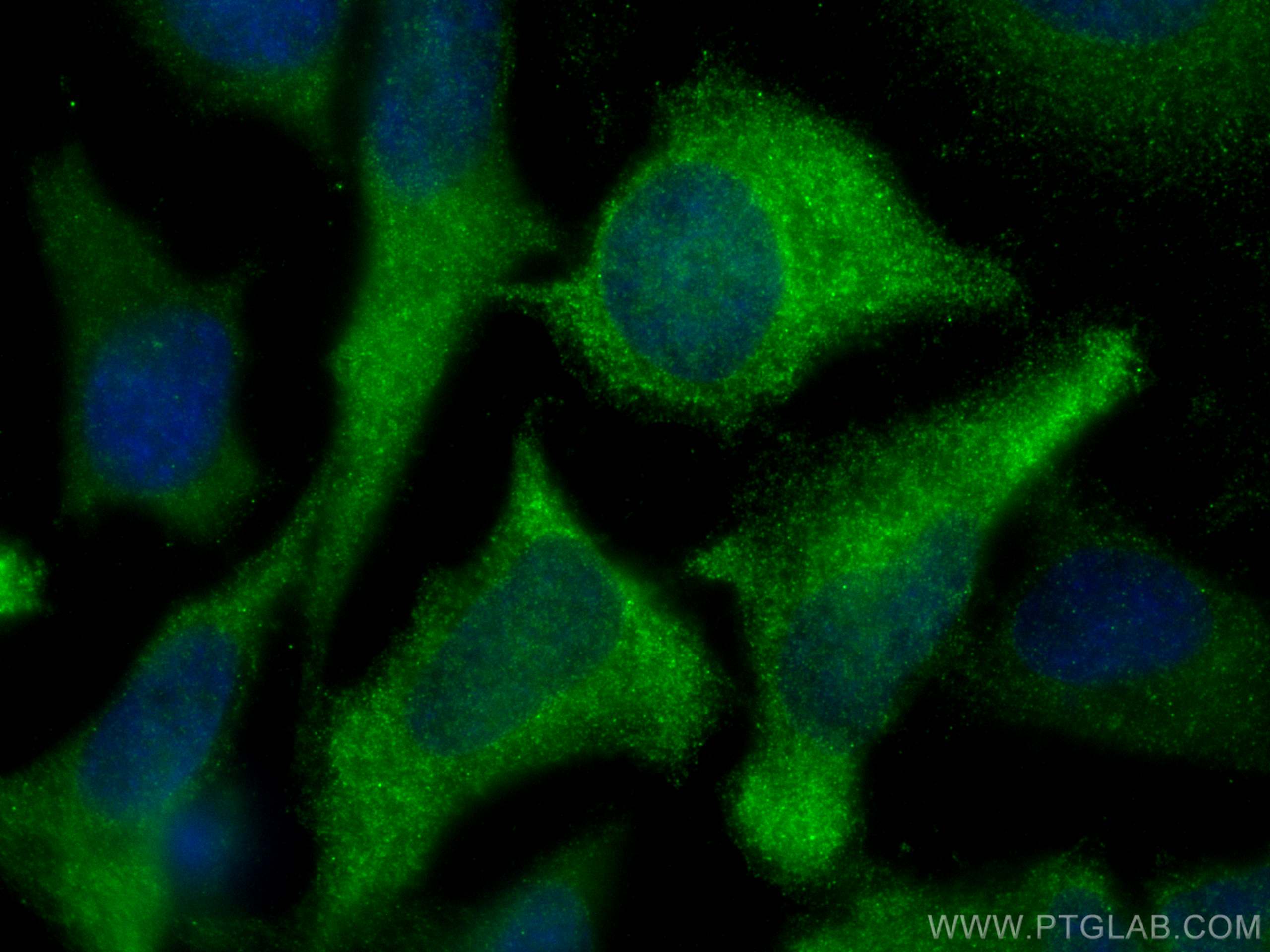 Immunofluorescence (IF) / fluorescent staining of HeLa cells using KYNU Polyclonal antibody (11796-1-AP)