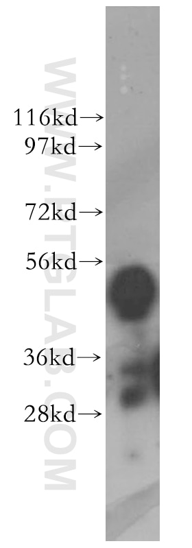 Western Blot (WB) analysis of HeLa cells using KYNU Polyclonal antibody (11796-1-AP)