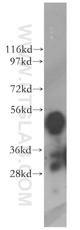 WB analysis of HeLa using 11796-1-AP