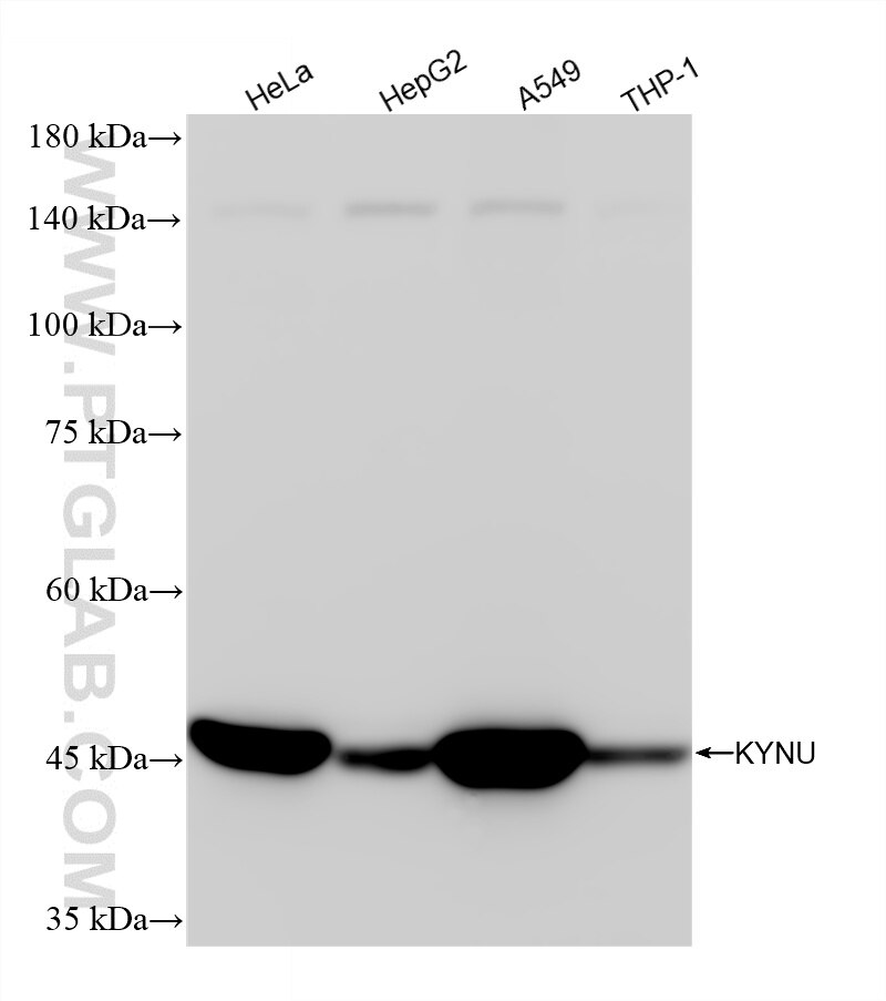 Western Blot (WB) analysis of various lysates using KYNU Recombinant antibody (86555-4-RR)