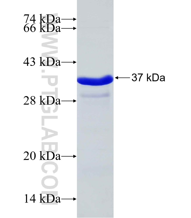 Kdm2b fusion protein Ag30369 SDS-PAGE Kdm2b fusion protein Ag30369 SDS-PAGE