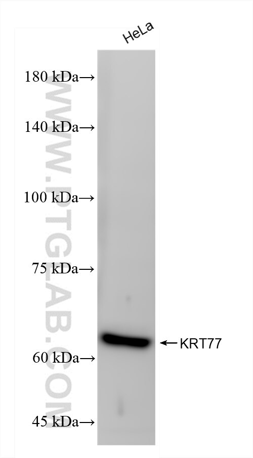 Western Blot (WB) analysis of HeLa cells using Keratin 77 Recombinant antibody (83415-3-RR)