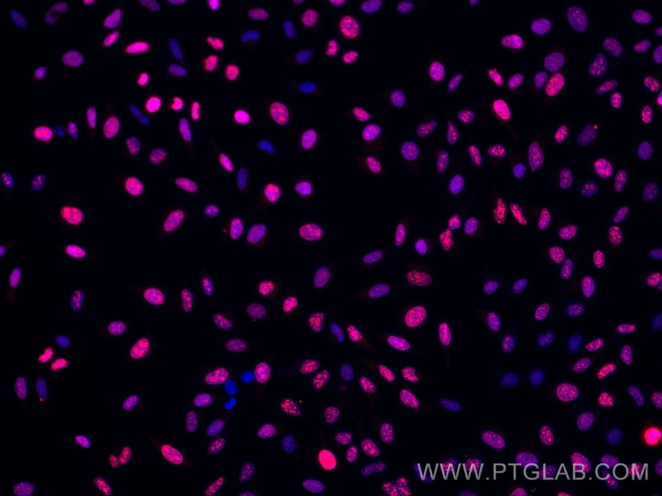 Immunofluorescent analysis of (4% PFA) fixed HeLa cells using Ki-67 antibody (66555-6-Ig, Clone: 1B9H2 ) at dilution of 1:2000 and Multi-rAb CoraLite® Plus 594-Goat Anti-Mouse Recombinant Secondary Antibody (H+L) (Cat.NO. RGAM004 ). Immunofluorescence (IF) / fluorescent staining of HeLa cells using Ki-67 Monoclonal antibody (66555-6-Ig)