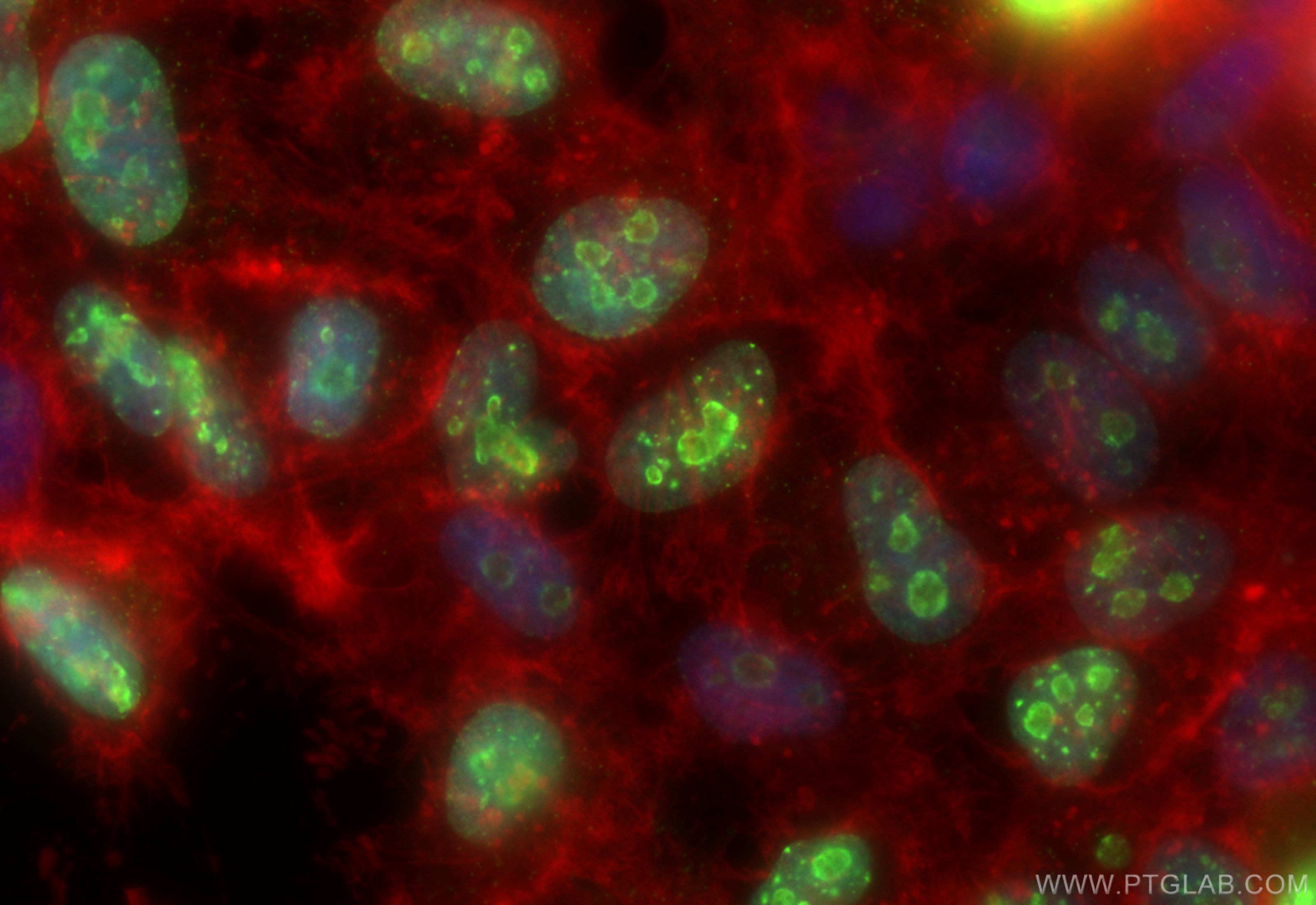 Immunofluorescence (IF) / fluorescent staining of HeLa cells using Ki-67 Recombinant antibody (84192-4-RR)