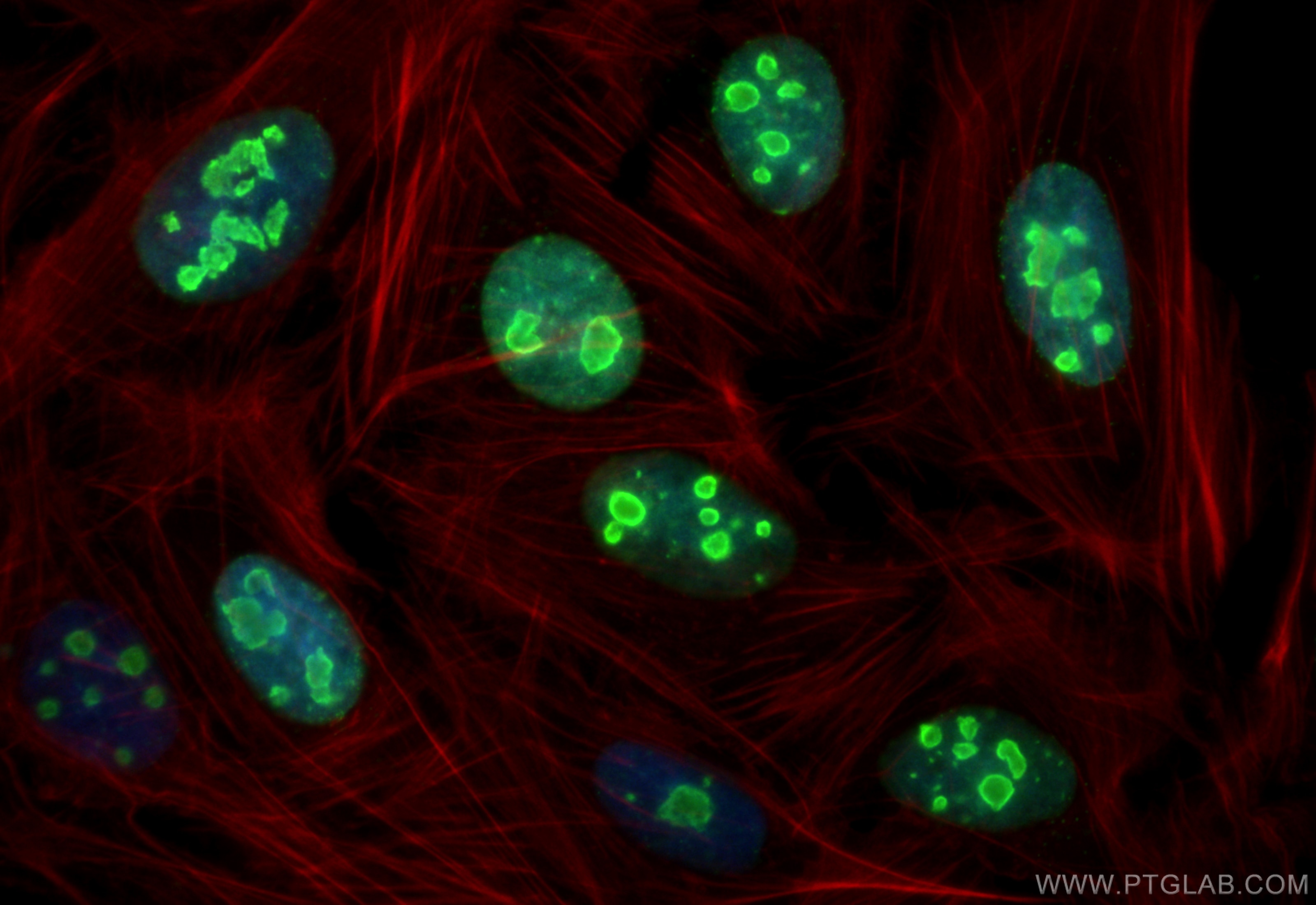 Immunofluorescence (IF) / fluorescent staining of U2OS cells using Ki-67 Recombinant antibody (84192-4-RR)