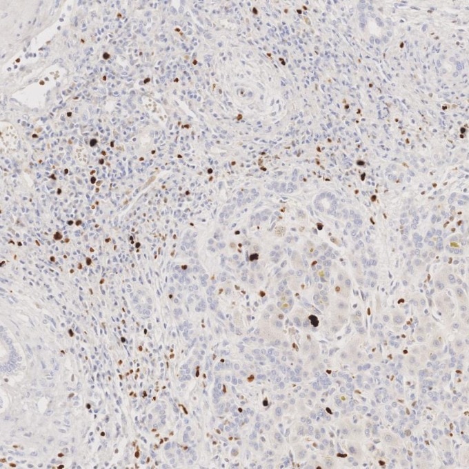 Immunohistochemistry (IHC) staining of human liver tissue using Ki-67 Recombinant monoclonal antibody (84192-4-RR)