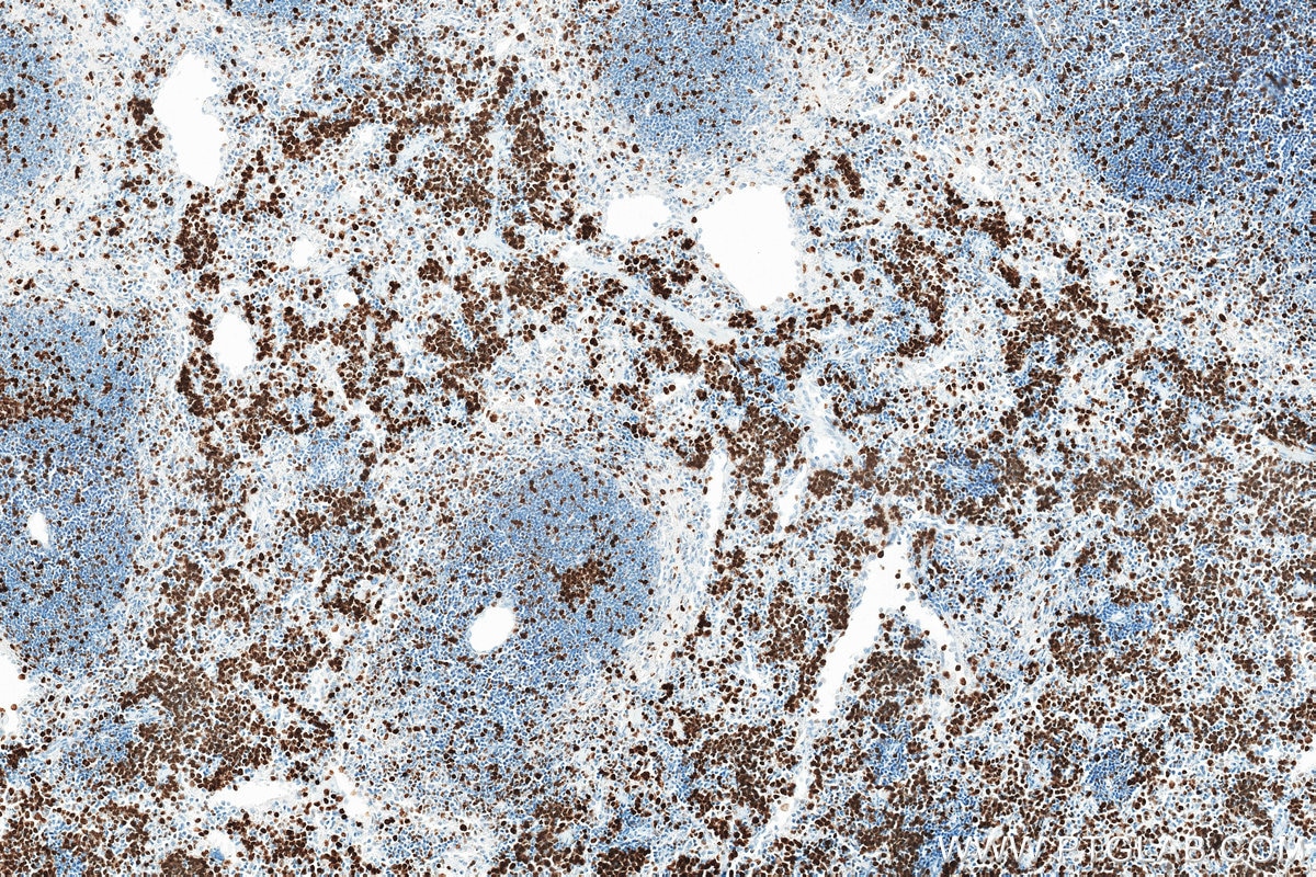 Immunohistochemistry (IHC) staining of mouse spleen tissue using Ki-67 Recombinant monoclonal antibody (84432-1-RR)