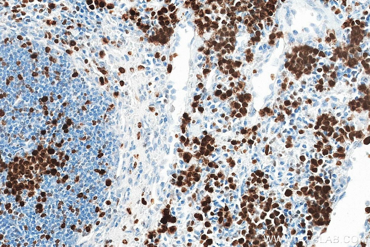 Immunohistochemistry (IHC) staining of mouse spleen tissue using Ki-67 Recombinant monoclonal antibody (84432-1-RR)