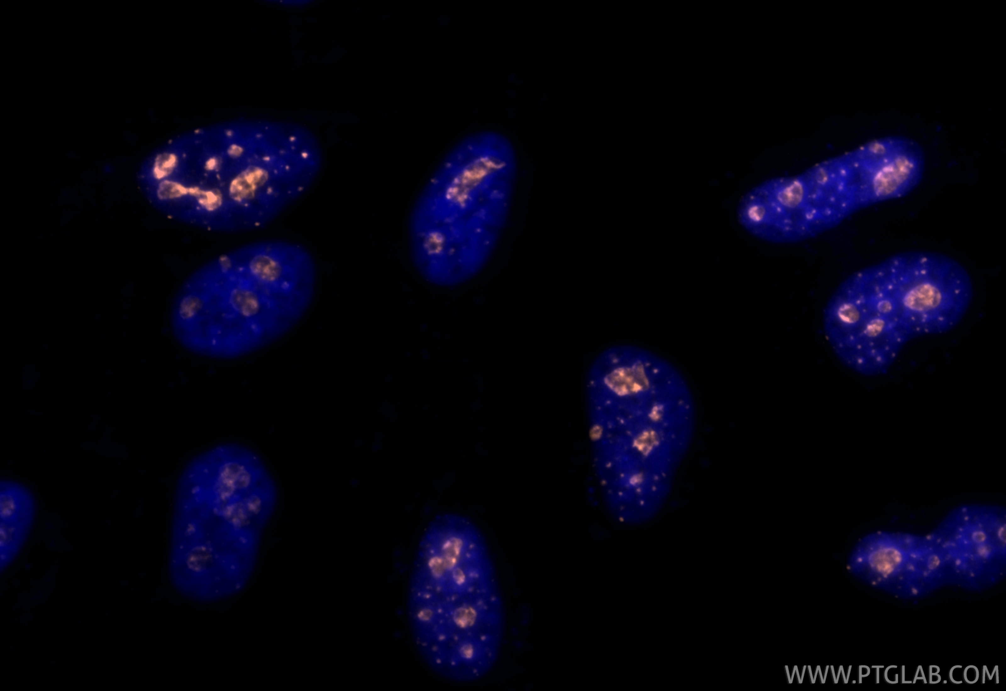 Immunofluorescence (IF) / fluorescent staining of HeLa cells using CoraLite® Plus 555-conjugated Ki-67 Recombinant an (CL555-84192-4)