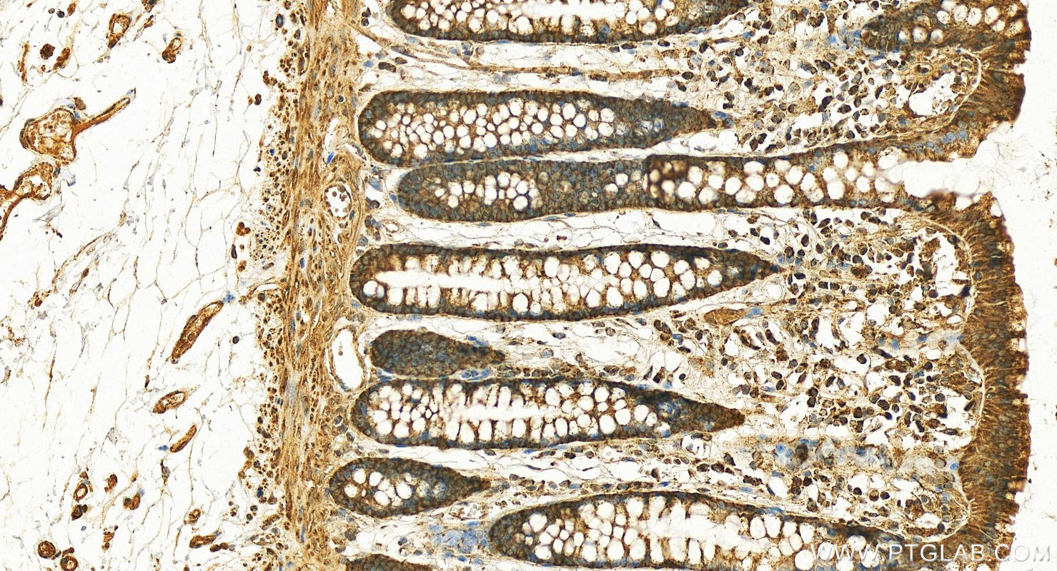Immunohistochemistry (IHC) staining of human colon tissue using Kindlin 2 Polyclonal antibody (29911-1-AP)