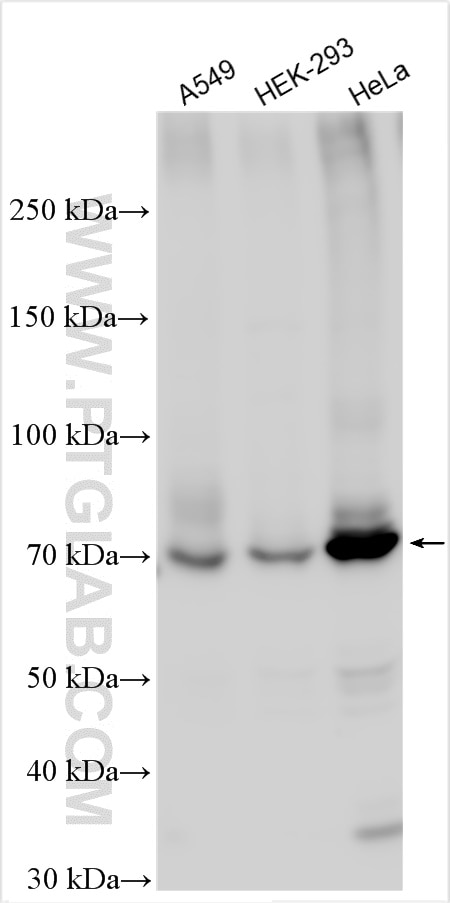 Western Blot (WB) analysis of various lysates using Kindlin 2 Polyclonal antibody (29911-1-AP)