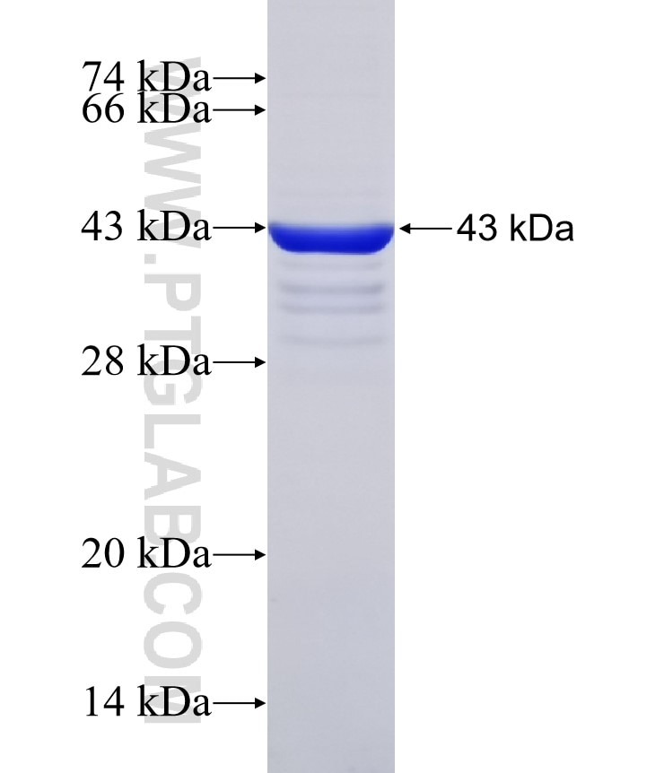 Kindlin 2 fusion protein Ag31795 SDS-PAGE