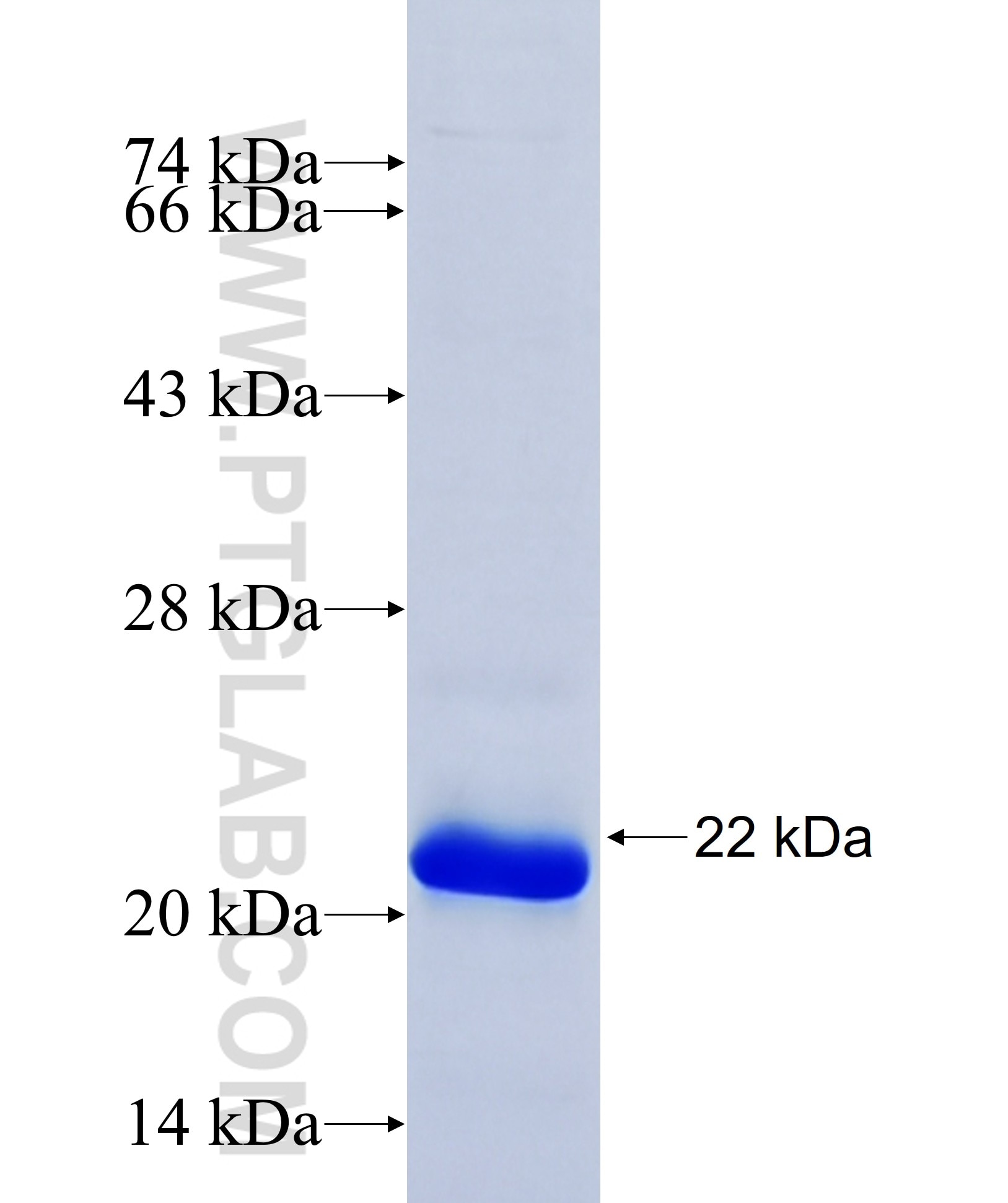 Kindlin 2 fusion protein Ag31802 SDS-PAGE Kindlin 2 fusion protein Ag31802 SDS-PAGE