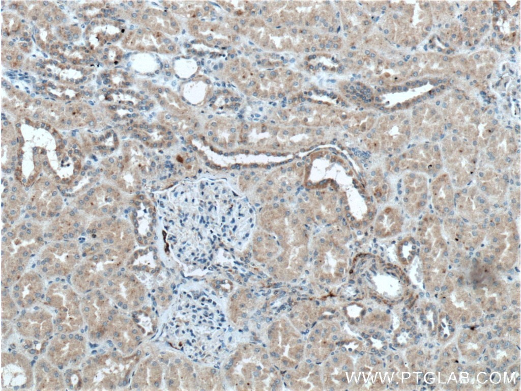 Immunohistochemistry (IHC) staining of human kidney tissue using Kininogen 1 Polyclonal antibody (27477-1-AP)