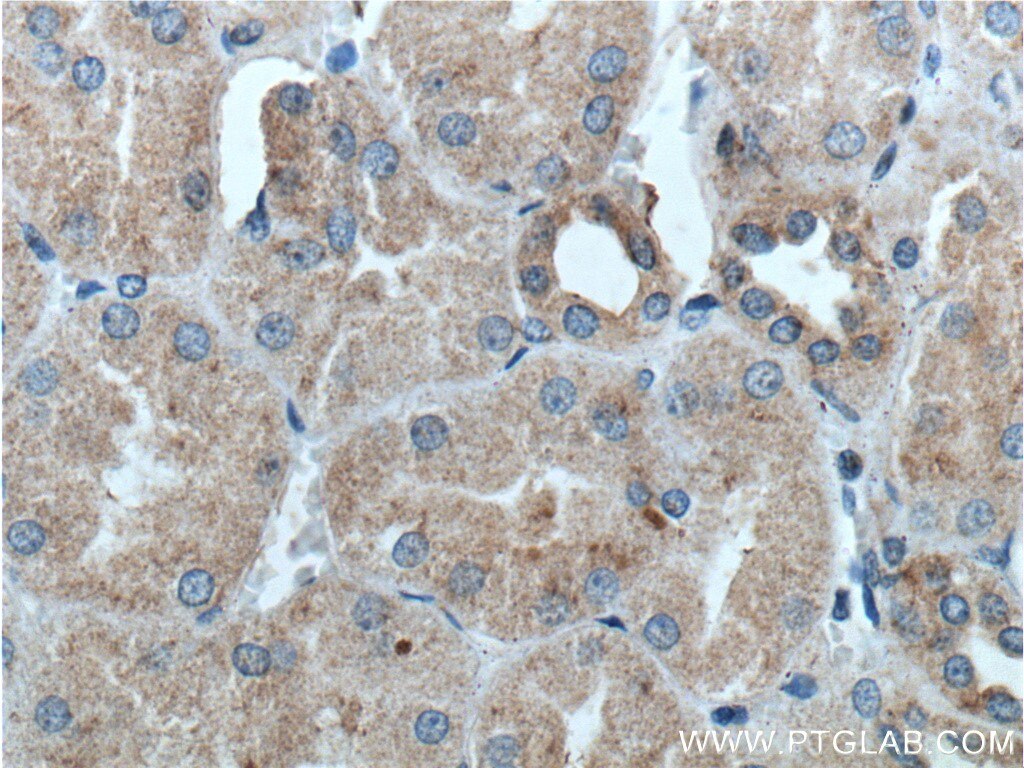 Immunohistochemistry (IHC) staining of human kidney tissue using Kininogen 1 Polyclonal antibody (27477-1-AP)