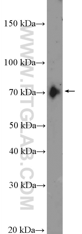 Kininogen 1