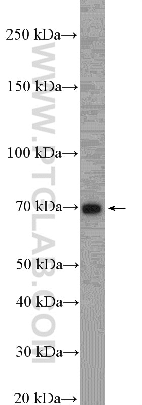 Western Blot (WB) analysis of HeLa cells using Kininogen 1 Polyclonal antibody (27477-1-AP)