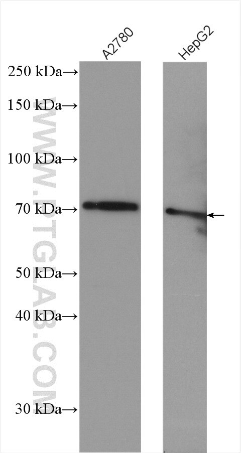 Western Blot (WB) analysis of various lysates using Kininogen 1 Polyclonal antibody (27477-1-AP)