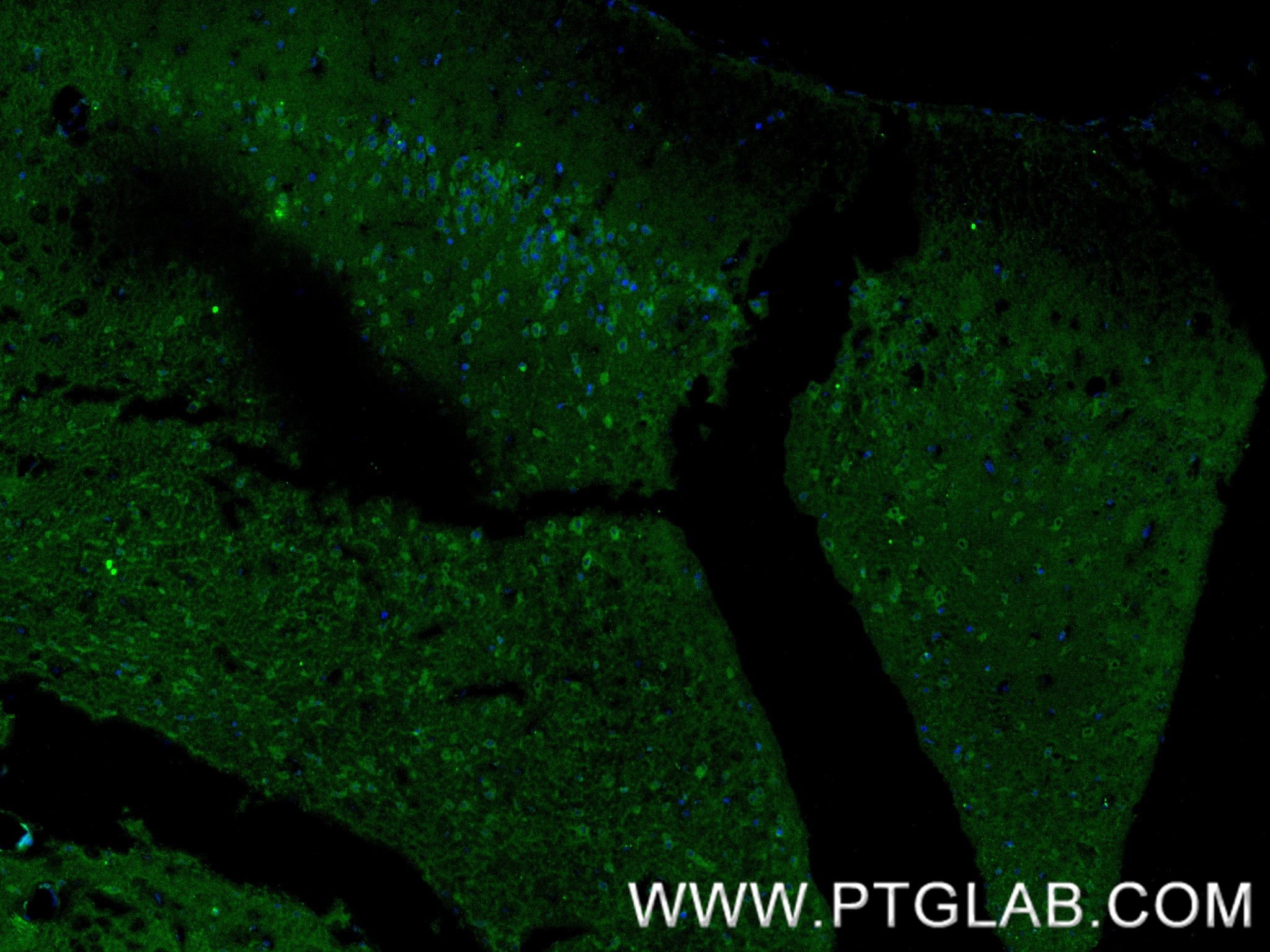 Immunofluorescence (IF) / fluorescent staining of mouse brain tissue using Kv4.2 Recombinant antibody (85133-3-RR)