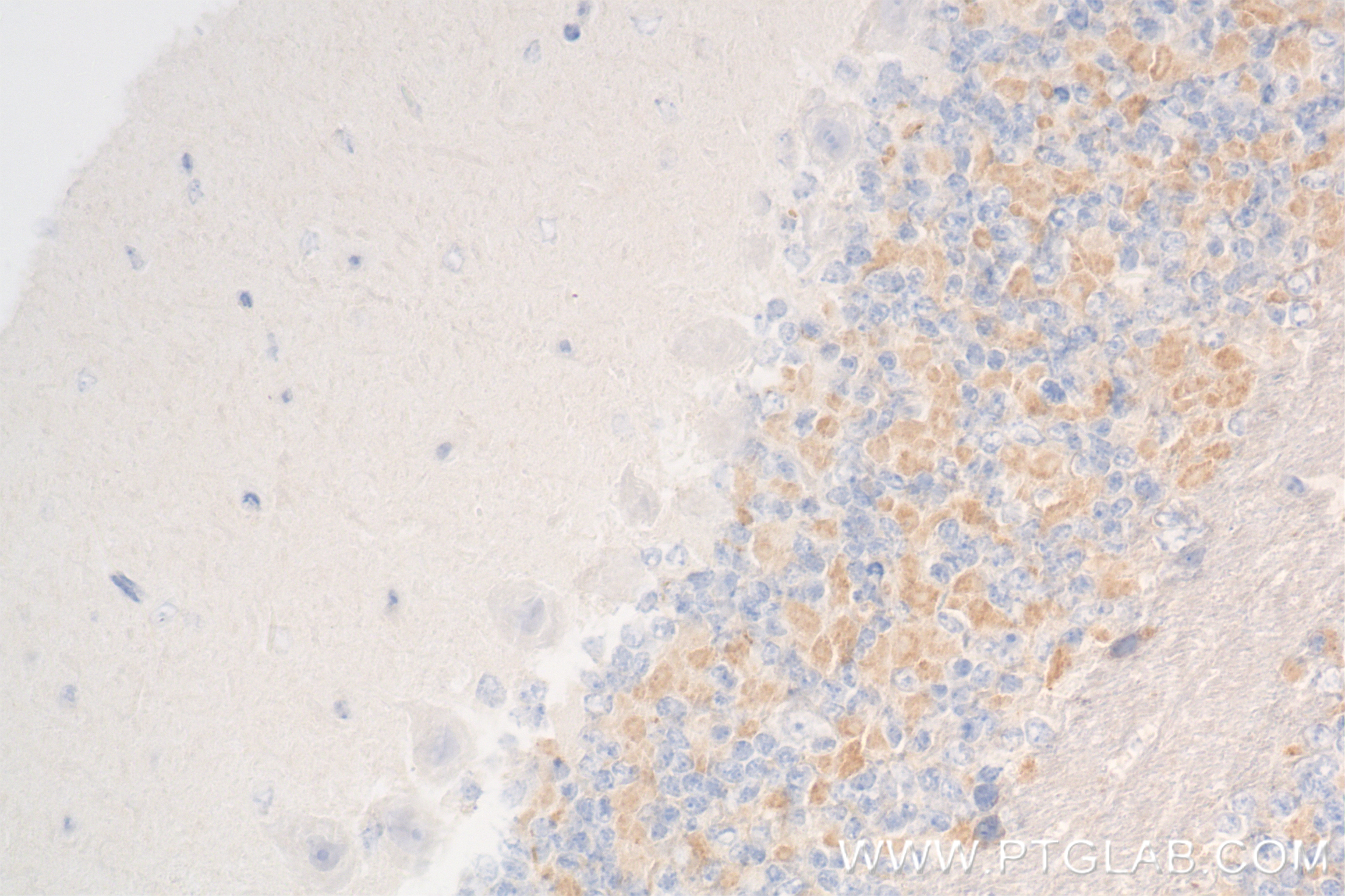 Immunohistochemistry (IHC) staining of mouse cerebellum tissue using Kv4.2 Recombinant antibody (85133-3-RR)