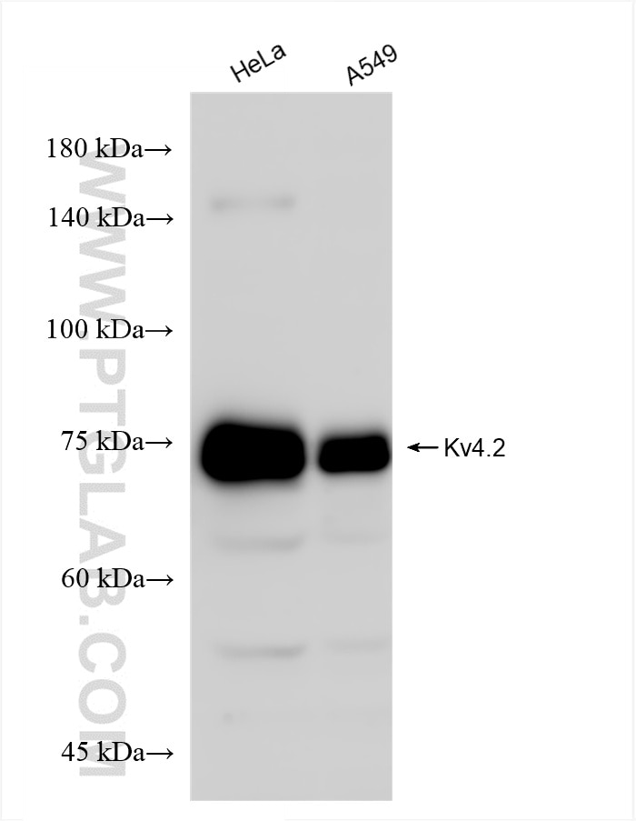 Western Blot (WB) analysis of various lysates using Kv4.2 Recombinant antibody (85133-3-RR)