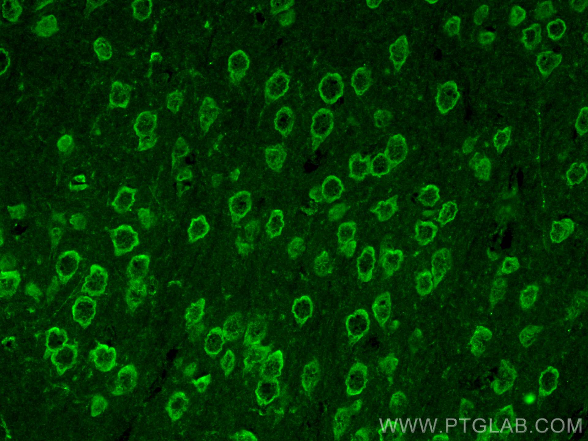 Immunofluorescence (IF) / fluorescent staining of mouse brain tissue using CoraLite® Plus 488-conjugated Kv4.2 Polyclonal ant (CL488-21298)