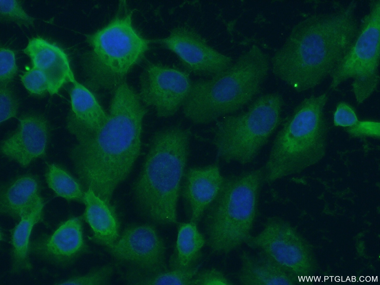 Immunofluorescence (IF) / fluorescent staining of A431 cells using L-Plastin Polyclonal antibody (55208-1-AP)