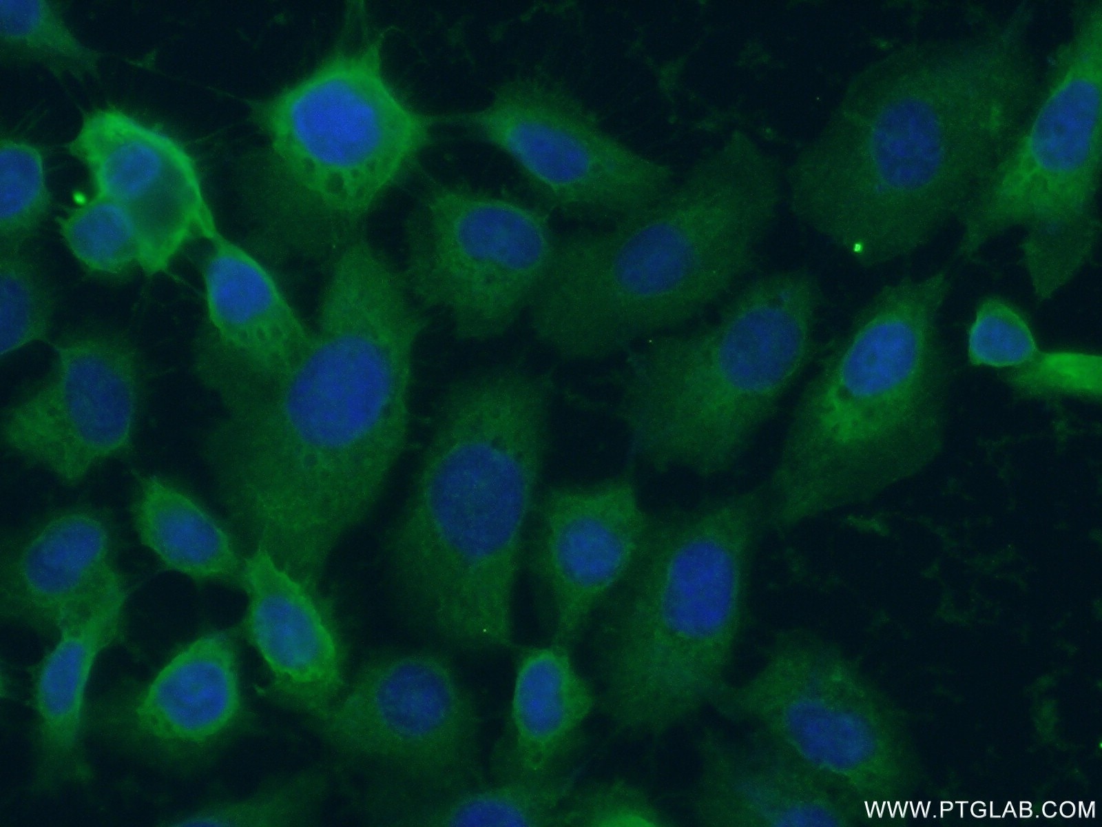 IF Staining of A431 using 55208-1-AP