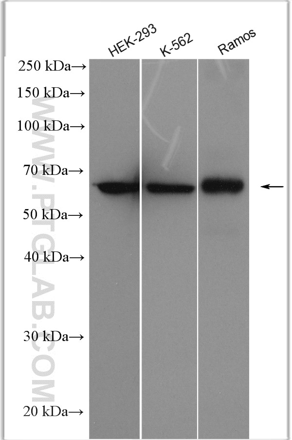 Western Blot (WB) analysis of various lysates using L-Plastin Polyclonal antibody (55208-1-AP)