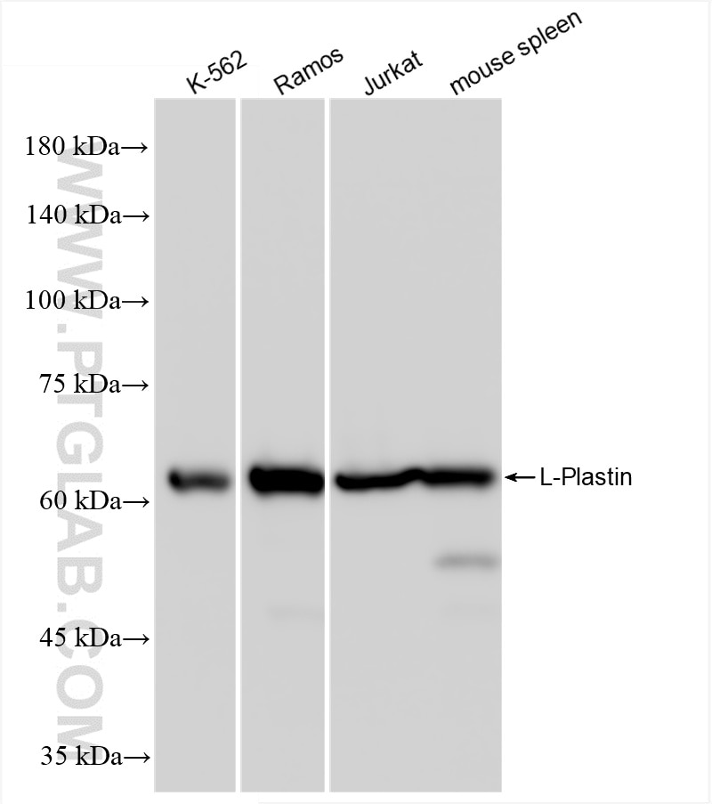 Western Blot (WB) analysis of various lysates using L-Plastin Recombinant antibody (86299-3-RR)