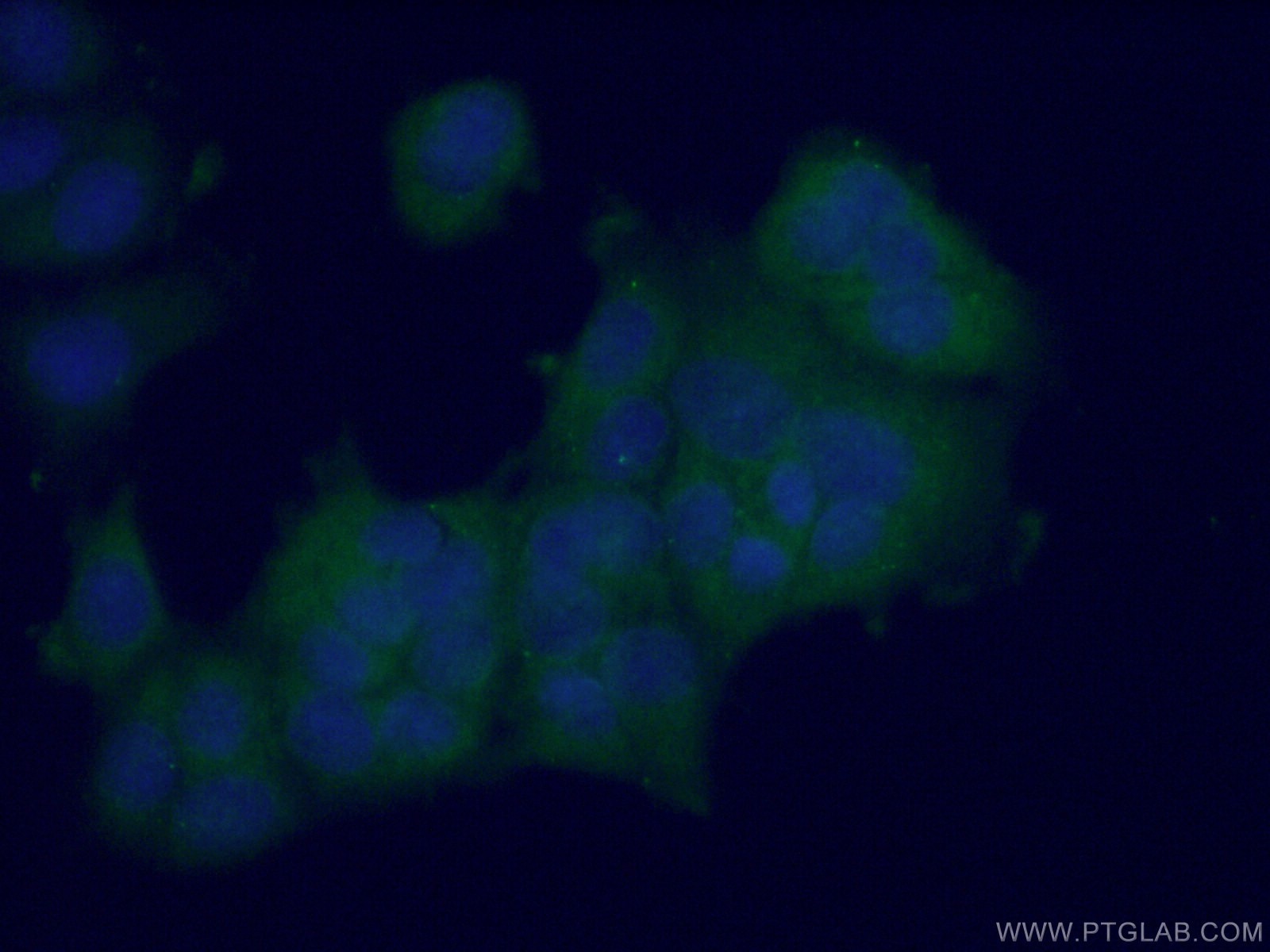 Immunofluorescence (IF) / fluorescent staining of MCF-7 cells using L-VEGFA Polyclonal antibody (22341-1-AP)