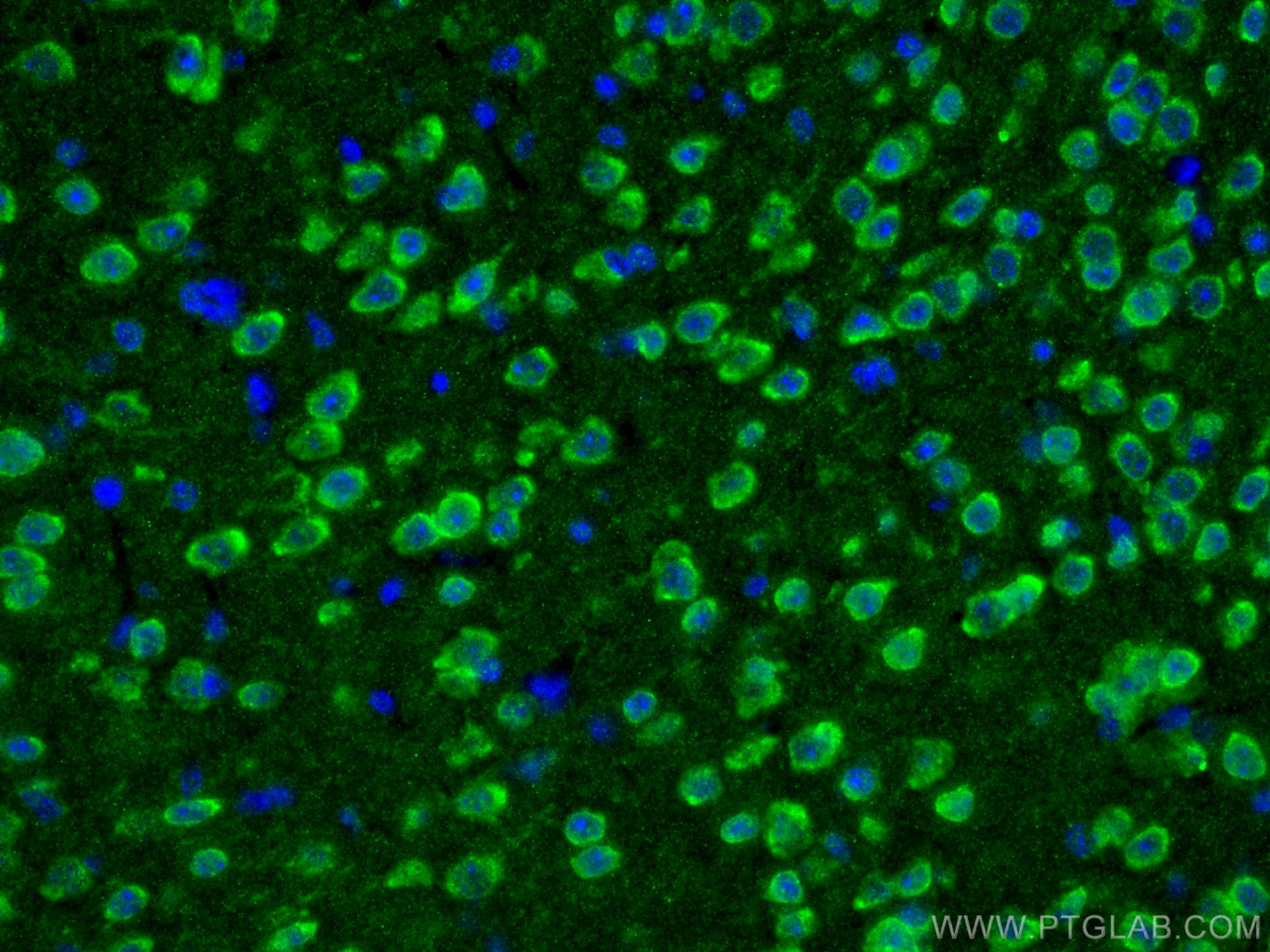 Immunofluorescence (IF) / fluorescent staining of mouse brain tissue using L-VOCC Polyclonal antibody (21774-1-AP)