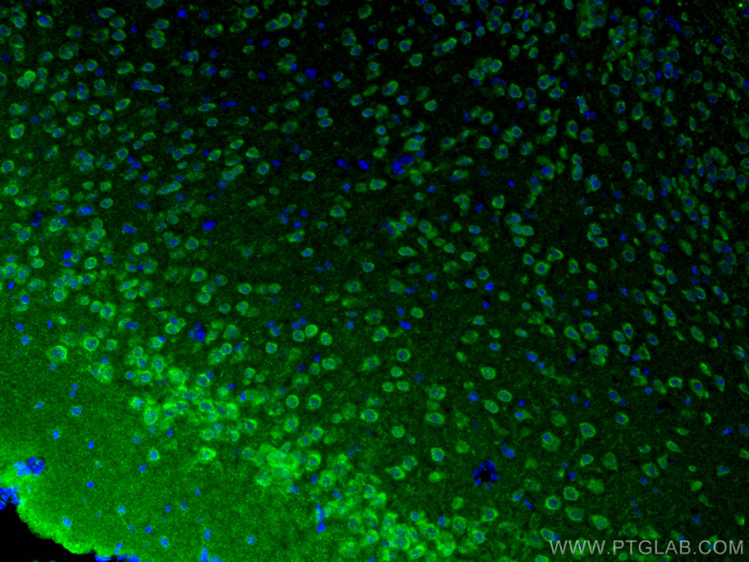 Immunofluorescence (IF) / fluorescent staining of mouse brain tissue using L-VOCC Polyclonal antibody (21774-1-AP)