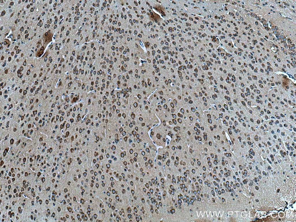 IHC staining of mouse brain using 21774-1-AP