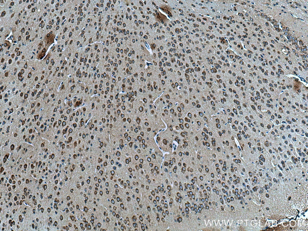 Immunohistochemistry (IHC) staining of mouse brain tissue using L-VOCC Polyclonal antibody (21774-1-AP)