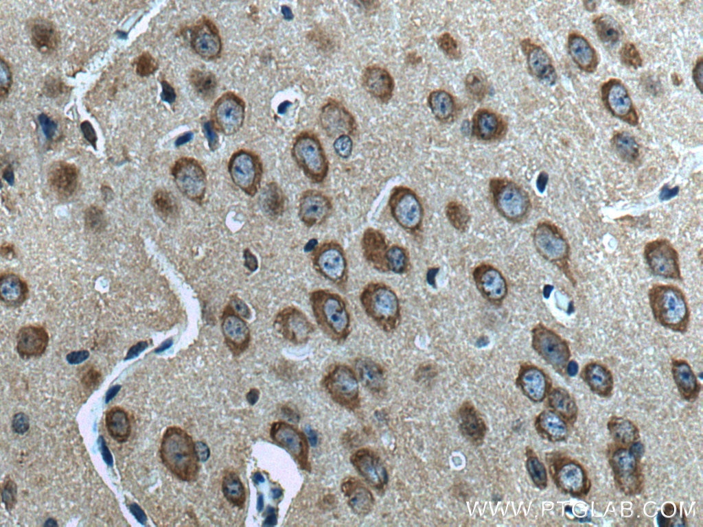 Immunohistochemistry (IHC) staining of mouse brain tissue using L-VOCC Polyclonal antibody (21774-1-AP)