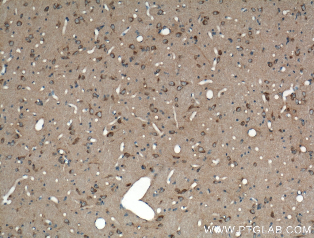 Immunohistochemistry (IHC) staining of rat brain tissue using L-VOCC Polyclonal antibody (21774-1-AP)