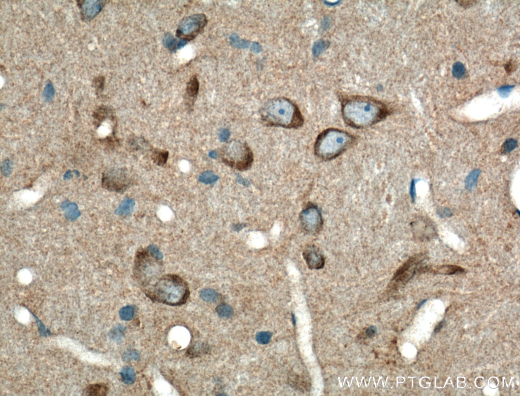 Immunohistochemistry (IHC) staining of rat brain tissue using L-VOCC Polyclonal antibody (21774-1-AP)